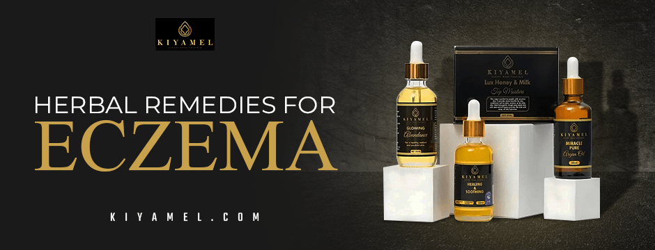 Top Herbal Remedies for Eczema Relief: Natural Solutions for Soothing Skin - Kiyamel