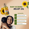 Eczema Relief Oil| Natural Soothing Solution for Eczema - Prone Skin - Kiyamel