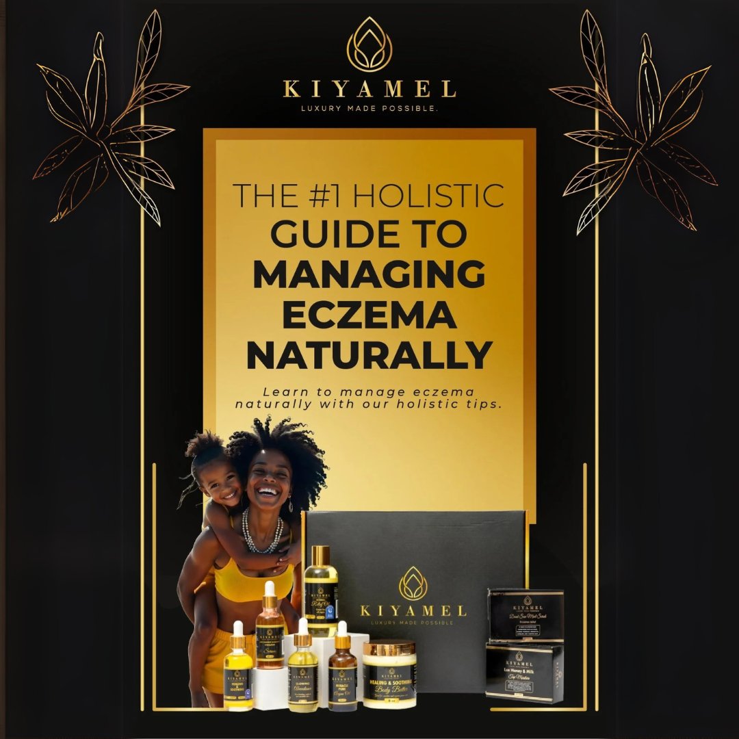 Eczema Uncovered: The #1 Holistic Guide to Managing Eczema Naturally - Kiyamel